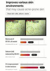 Before and after comparison of skin environment with text on improvements for acne-prone skin.