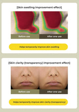 Before and after effect of a skin care product on skin swelling and clarity.