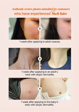 Before and after images of skin conditions treated with Medi-Balm, submitted by customers.