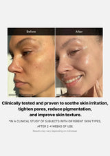 Before and after skin comparison with clinical text on a white background