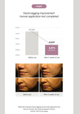 Facial sagging improvement test results with before and after images and a graph.