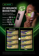 Promotional graphic for an MC Mode skincare device showing a woman applying the device to her face, with glowing green light effects and text claiming 2X bounce boosting for healthy-looking bounce. The image includes before-and-after skin texture comparison panels at the bottom on a dark green background.