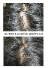 Close-up of hair with text indicating black and denser hair sprouting out