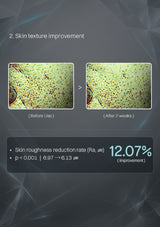 A dark promotional graphic showing before-and-after skin texture comparison images with text reading '2. Skin texture improvement' and a statistic of 12.