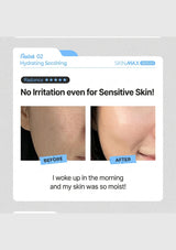 [AALOK] Skinmax Device | Skincare Serums