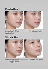 [AALOK] Skinmax Device | Skincare Serums