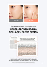 Before and after comparison of skin elasticity with text about PDRN and collagen blend design.