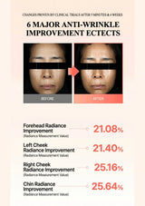 Before and after comparison of anti-wrinkle treatment with radiance improvement percentages.