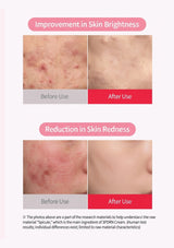 A before-and-after comparison infographic showing skin improvement. The top panel shows a close-up of skin labeled 'Before Use' and 'After Use' under the heading 'Improvement in Skin Brightness.
