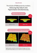 Clinical results infographic for PDRN cream, showing before-and-after sebum reduction and UV pigmentation improvement with colorful skin texture imagery and percentage reductions.