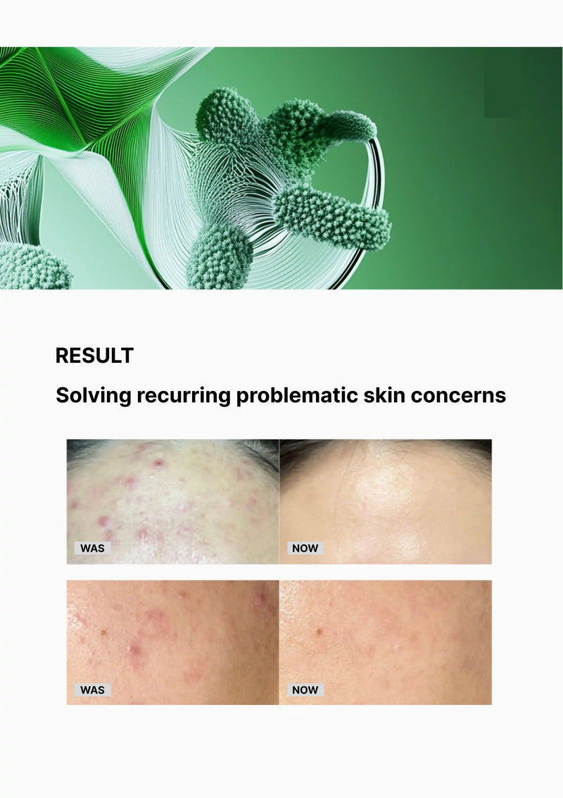 Before and after comparison of skin concerns with a green background and plant imagery.