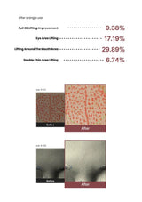Before and after results of a skincare treatment with statistical data on improvement percentages.