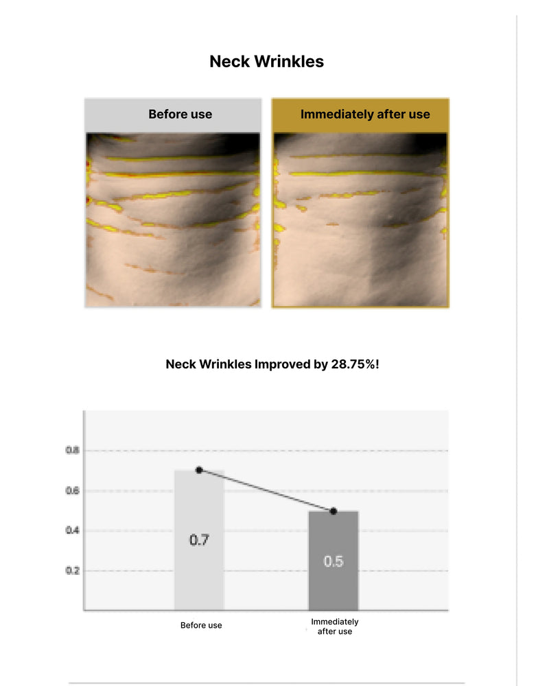 Before and after comparison of neck wrinkles with a graph showing improvement.