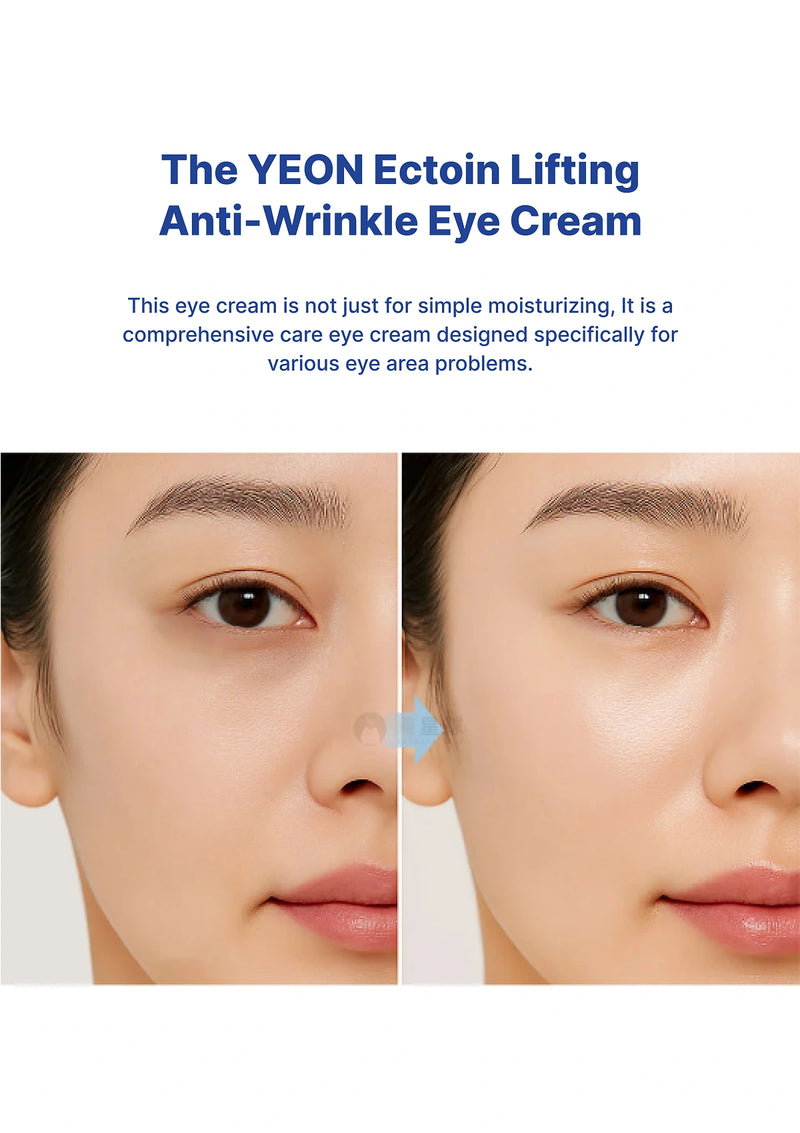 Advertisement for YEON Ectoin Lifting Anti-Wrinkle Eye Cream showing before and after effects on eye area.