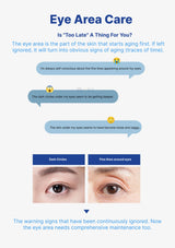 Eye area care infographic with text and images of eye concerns.