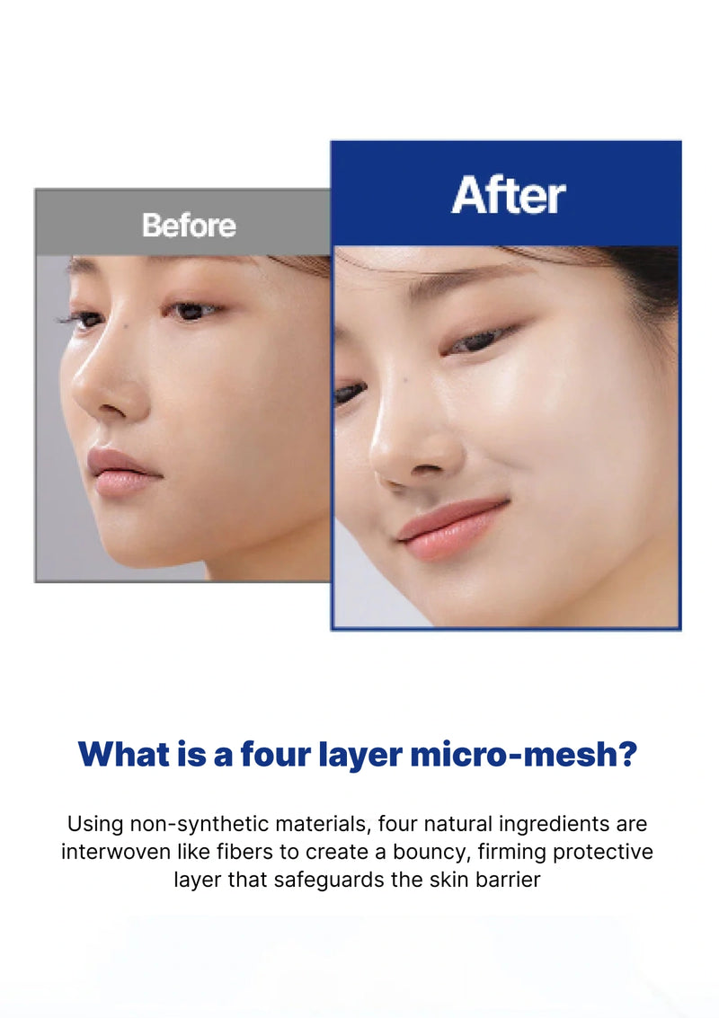 Before and after comparison of a person's face with text about a four-layer micro-mesh product.
