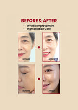 Before and after comparison of wrinkle improvement and pigmentation care on a beige background.