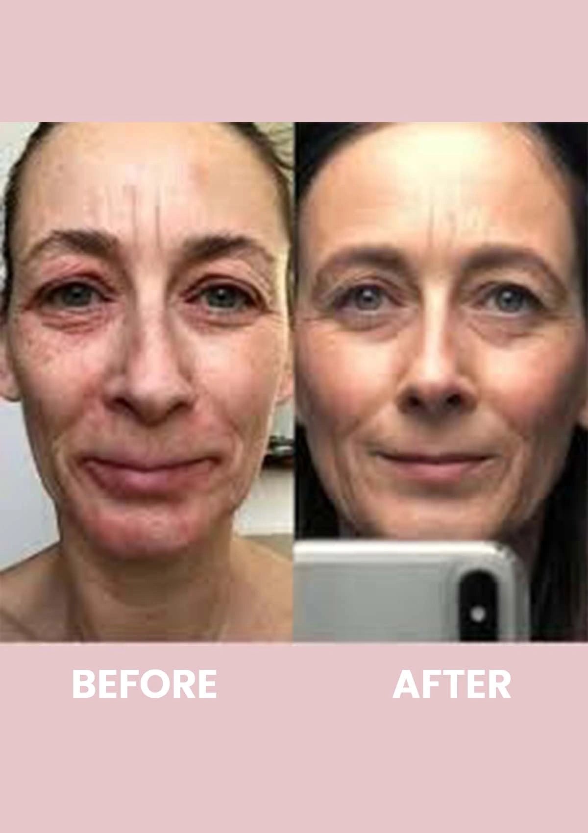 Before and after comparison of a woman's face with visible aging signs.