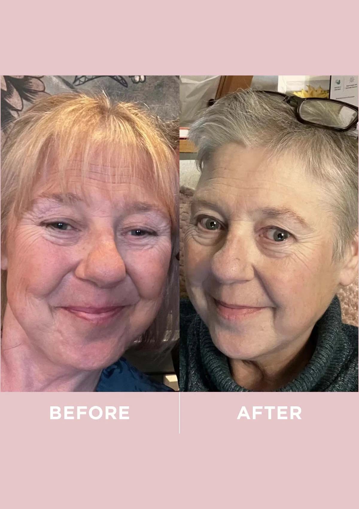 Before and after comparison of a woman's face on a pink background