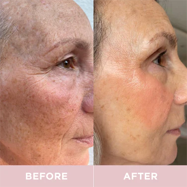 Revive Collagen Enhanced Plus - Hydrolysed Marine Collagen Drink