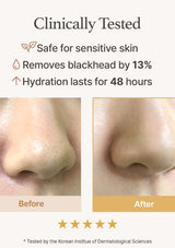 Before and after skin comparison with text highlighting product benefits on a white background.