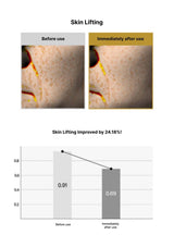 Before and after skin lifting comparison with a graph showing improvement.