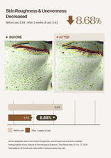 Before and after comparison of skin roughness with a numerical decrease shown.