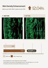 Skin density enhancement before and after results with a 12.04% increase.