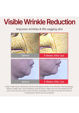 Advertisement for visible wrinkle reduction with before and after effects on skin.