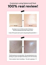 Before and after skin improvement using Nuborncell Pack on a pink background with text.