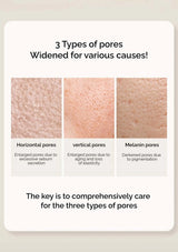 Diagram showing three types of widened pores with labels and text on a light background