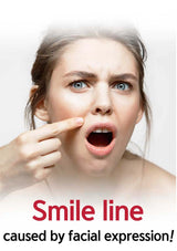 Woman pointing to her smile line with text 'Smile line caused by facial expression' on a white background