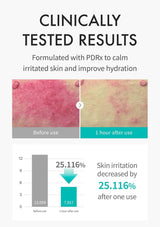 Before and after effect of a skincare product on irritated skin with clinical data.