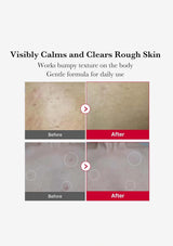 Before and after comparison of skin texture with text indicating product benefits.
