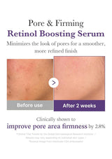Advertisement for pore and firming retinol boosting serum showing before and after effects on skin.