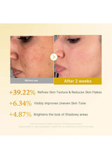 Before and after skin treatment comparison with text on a beige background