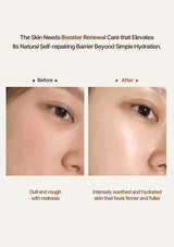 Before and after comparison of skin care treatment with text about booster renewal care.