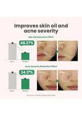 Before and after effects of a skincare product on skin oil and acne severity with statistical data.