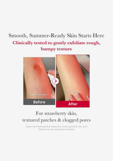 Before and after skin treatment showing smooth skin texture with text about clinical testing and benefits.