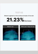 Before and after skin melanin pigment reduction test showing 21.23% decrease with text 'TEST 02' and '21.23% Decrease'.