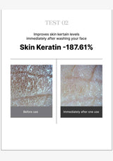 Before and after comparison of skin texture improvement with Skin Keratin, showing a decrease of 187.61%.