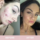 Revive Collagen Original - Hydrolysed Marine Collagen Drink