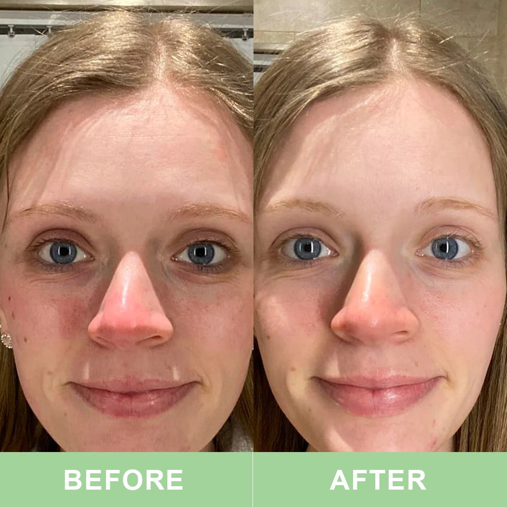 Revive Collagen Vegan - The World's First Clinically Proven Vegan Collagen