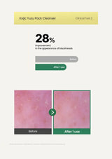 AXIS-Y Kojic Yuzu Pack Cleanser 60g — blackhead results; original brand product information