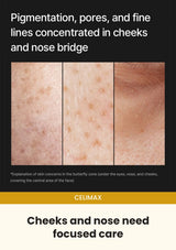 CELIMAX Pore + Dark Spot Brightening Cream — Cheeks and nose need focused care