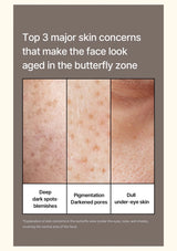CELIMAX Pore + Dark Spot Brightening Cream — Know the areas to target