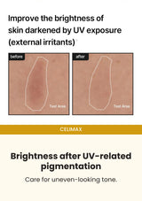 CELIMAX Pore + Dark Spot Brightening Cream — Brightness after UV-related pigmentation