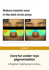 CELIMAX Pore + Dark Spot Brightening Cream — Care for under-eye pigmentation