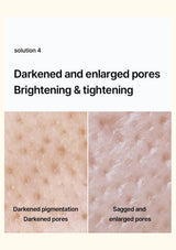 CELIMAX Pore + Dark Spot Brightening Cream — Darkened and enlarged-looking pores