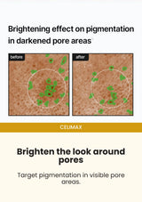 CELIMAX Pore + Dark Spot Brightening Cream — Brighten the look around pores